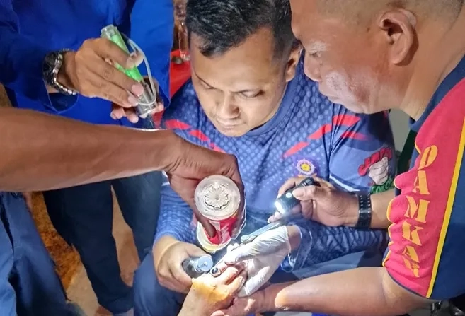 Damkar Bondowoso Lepas Cincin Jari Korban Kecelakaan