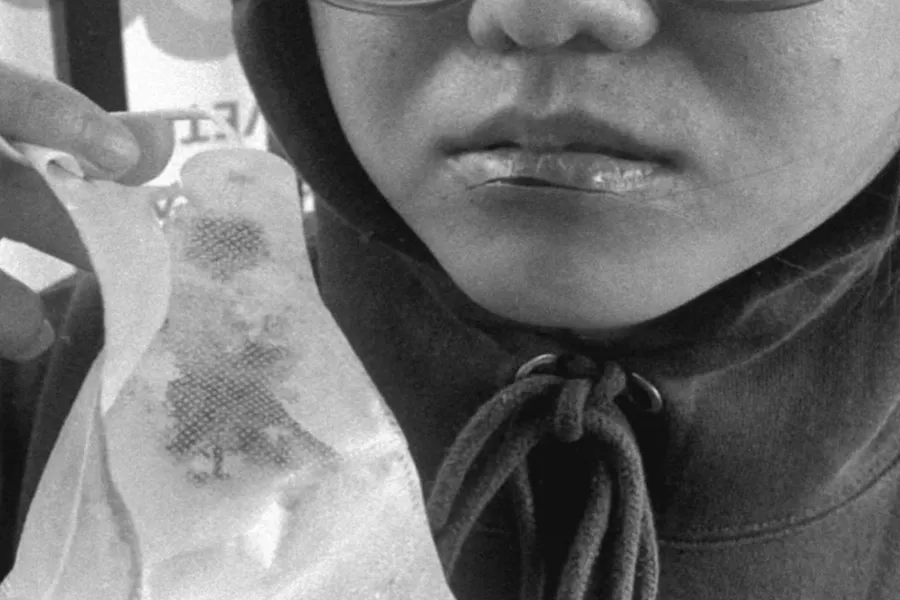 Senar Layangan Lukai Wajah Pemotor di Pondok Tjandra
